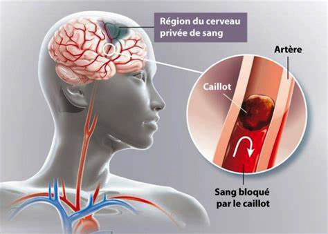santé éducation